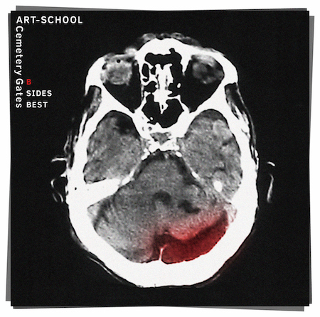 ART-SCHOOL、B SIDESベストの曲目判明 廃盤作品からの楽曲も